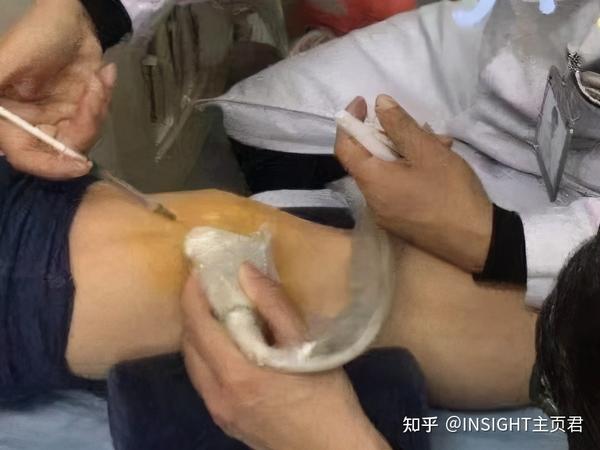 瑞典決賽杯世界男乒名單_瑞典男乒隊員_瑞典男乒世界杯決賽